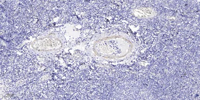 COLL2 rabbit pAb