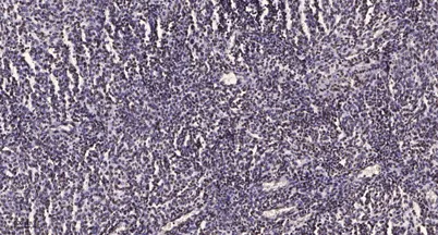 ERK1 Rabbit rabbit pAb - image 1