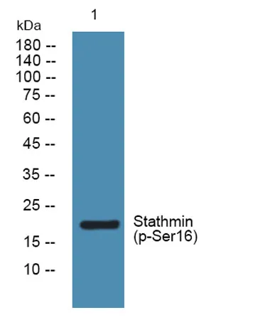 Stathmin (phospho-Ser16) rabbit pAb - image 1
