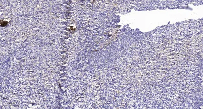 ITGA2B (light chain form 1, Cleaved-Gln891) rabbit pAb - image 1