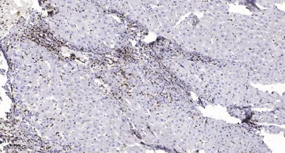 MMP21 (Cleaved-Ser145) rabbit pAb