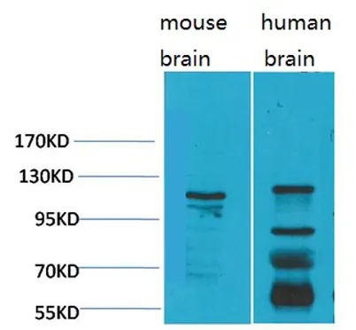 CaVα2δ3 rabbit pAb