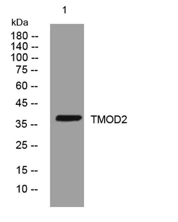 TMOD2 rabbit pAb - image 1