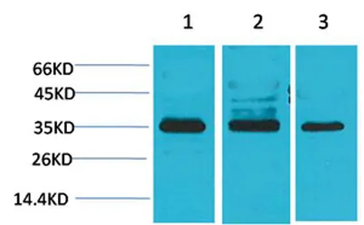 L-type Ca++ CP γ4 rabbit pAb - image 1