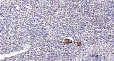 Karyopherin α2 (Acetyl Lys22) rabbit pAb - image 1