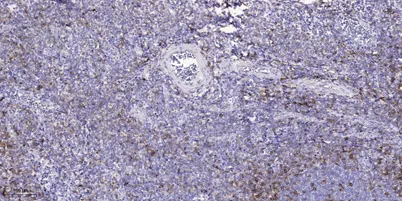 CSMD2 rabbit pAb