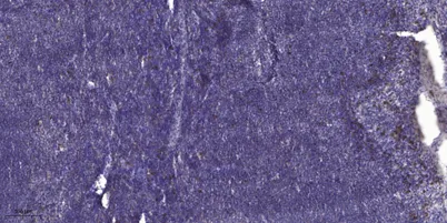 CTGF rabbit pAb