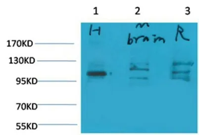 Glutamate Receptor 1 rabbit pAb