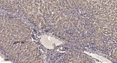 ITGAV (light chain, Cleaved-Asp891) rabbit pAb - image 1
