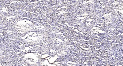 PKCδ (phospho-Ser359) rabbit pAb