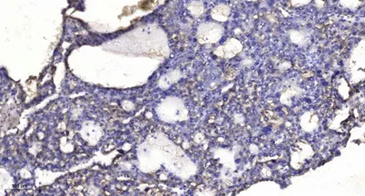 SQSTM1/p62 (phospho-Thr269/Ser272) rabbit pAb