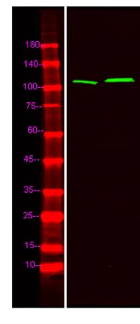 Catenin δ-1 (phospho-Tyr904) rabbit pAb - image 1