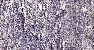 PLCγ2 (phospho-Tyr759) rabbit pAb - image 1
