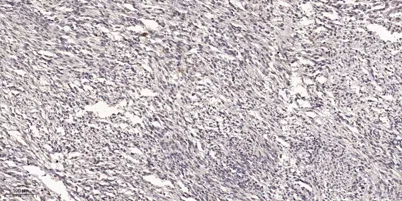 ATG4b Rabbit rabbit pAb - image 1