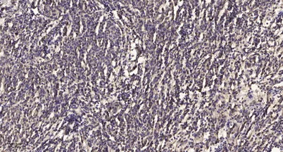 MYH-pan (Acetyl Lys505) rabbit pAb - image 1