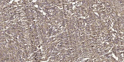 GRK2 (Phospho-Tyr86) rabbit pAb - image 1