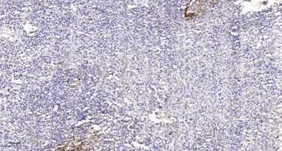 Smad1 (Phospho Ser214) rabbit pAb - image 1