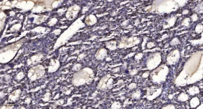 Raptor (phospho-Ser792) rabbit pAb
