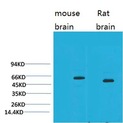 EAAT2 rabbit pAb - image 1
