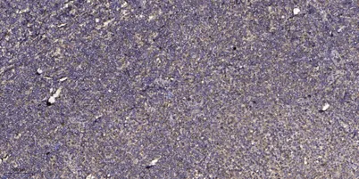 Adrenocorticotropin (ACTH) rabbit pAb
