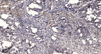 Rb (phospho Ser612) rabbit pAb - image 1