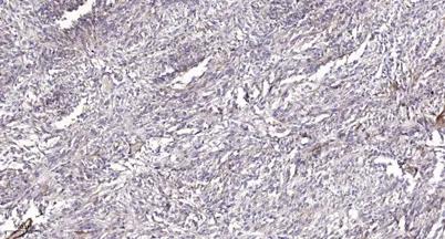 PI3 Kinase Class III (phospho-Ser249) rabbit pAb - image 1