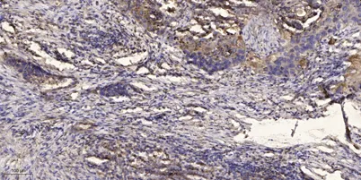 ITIH4 (80k, Cleaved-Arg689) rabbit pAb