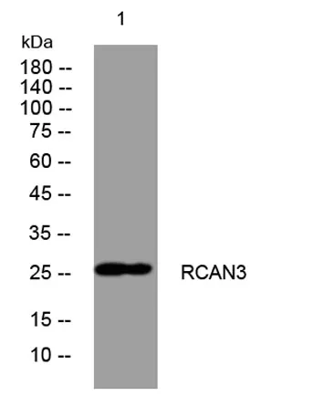 RCAN3 rabbit pAb - image 1