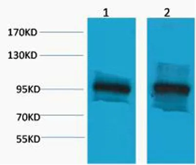 β-Catenin rabbit pAb - image 1