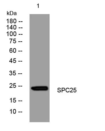 SPC25 rabbit pAb