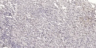 NBR1 Rabbit rabbit pAb - image 1