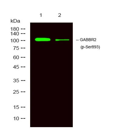 GABBR2 (Phospho Ser893) rabbit pAb - image 1
