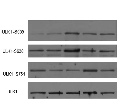 ULK1 (phospho-Ser555) rabbit pAb - image 1