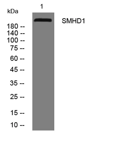 SMHD1 rabbit pAb
