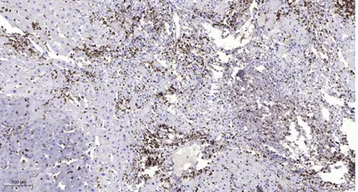MMP26 (Cleaved-Thr90) rabbit pAb - image 1
