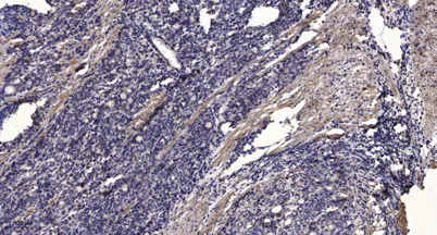 JAK3 (Phospho Tyr981) rabbit pAb - image 1