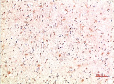 PI3 Kinase P85 Rabbit rabbit pAb - image 1