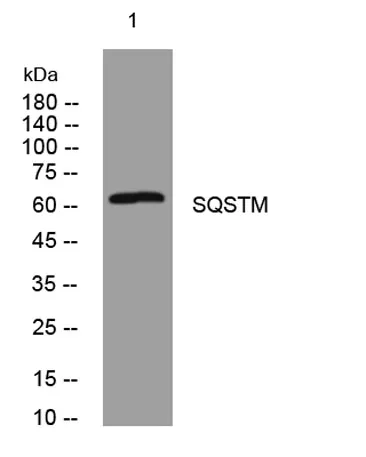SQSTM1/p62 rabbit pAb - image 1