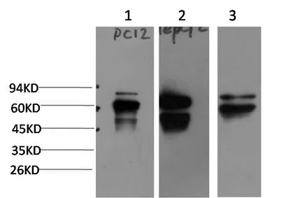 Peripherin Rabbit pAb - image 1