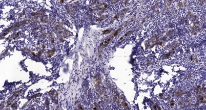 PP2B-Aα rabbit pAb - image 1