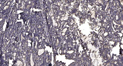 ITGA5 (heavy chain, Cleaved-Arg894) rabbit pAb - image 1