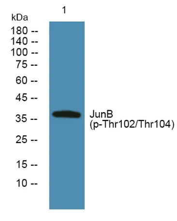 JunB (phospho-Thr102/Thr104) rabbit pAb - image 1