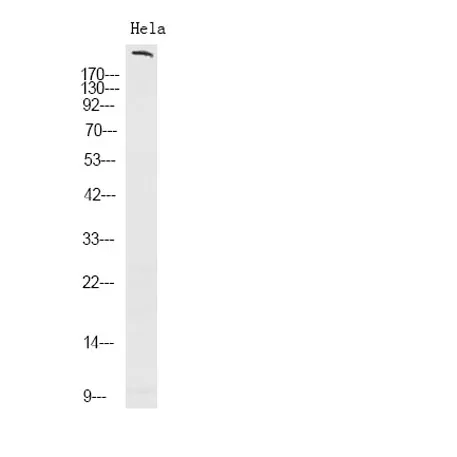 ROS1 (phospho-Tyr2274) rabbit pAb
