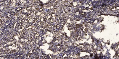 PDK1 (Phospho Tyr243) rabbit pAb - image 1