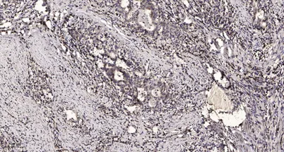 PGCA (Cleaved-Ala17) rabbit pAb - image 1