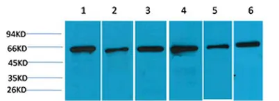 AMPKα2 rabbit pAb