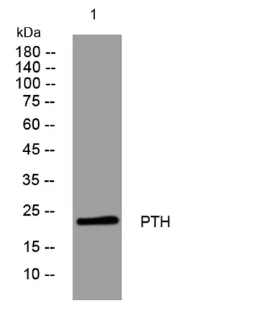 PTH rabbit pAb - image 1