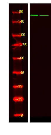 IGF-I Receptor β (phospho-Tyr980) rabbit pAb - image 1