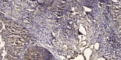 Jak2 (phospho-Tyr1008) rabbit pAb - image 1