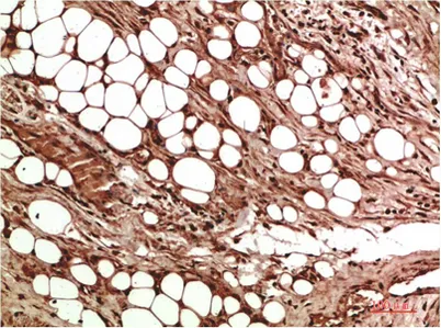VEGF Rabbit rabbit pAb - image 1